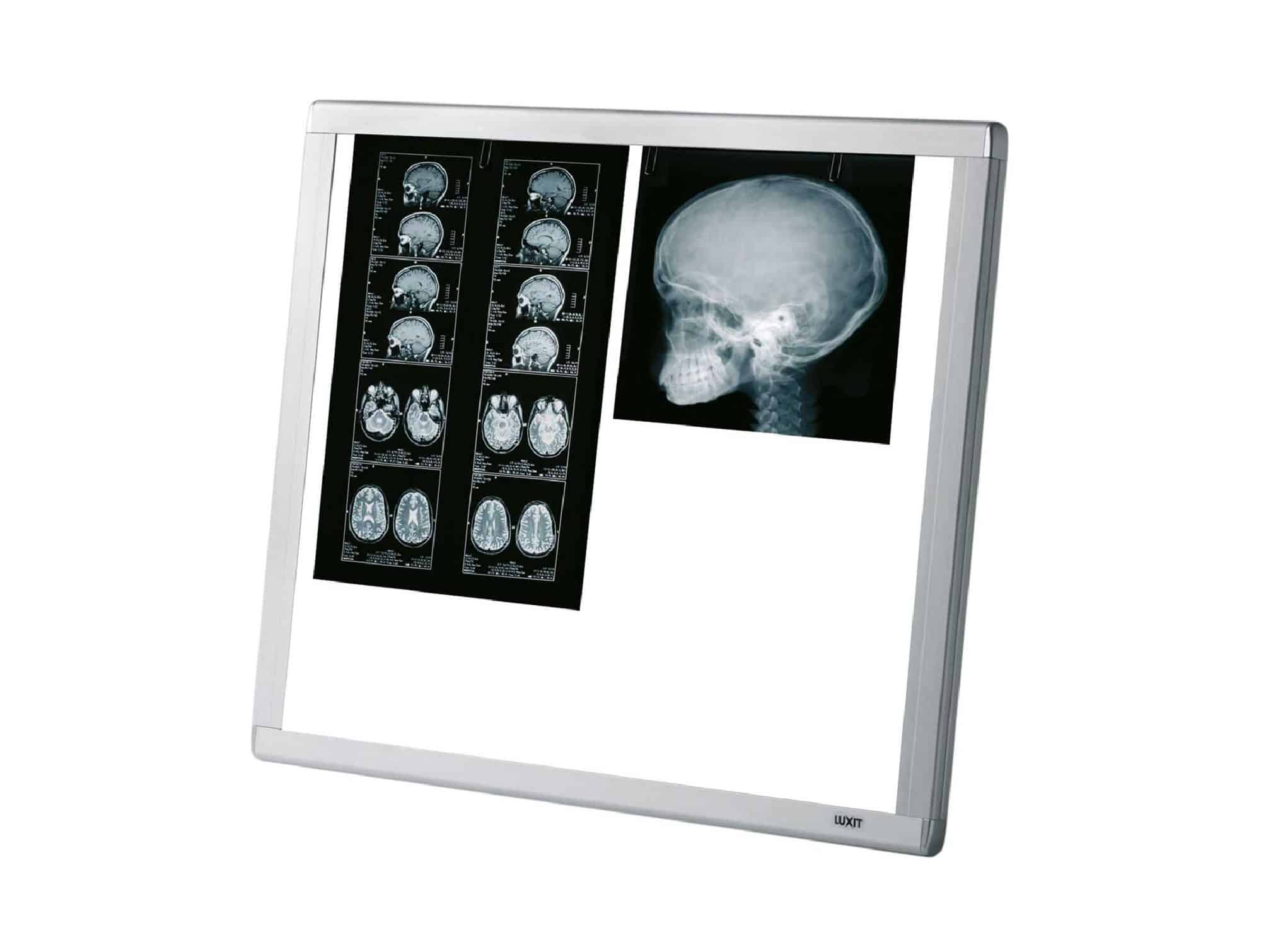Négatoscope LED Locamed