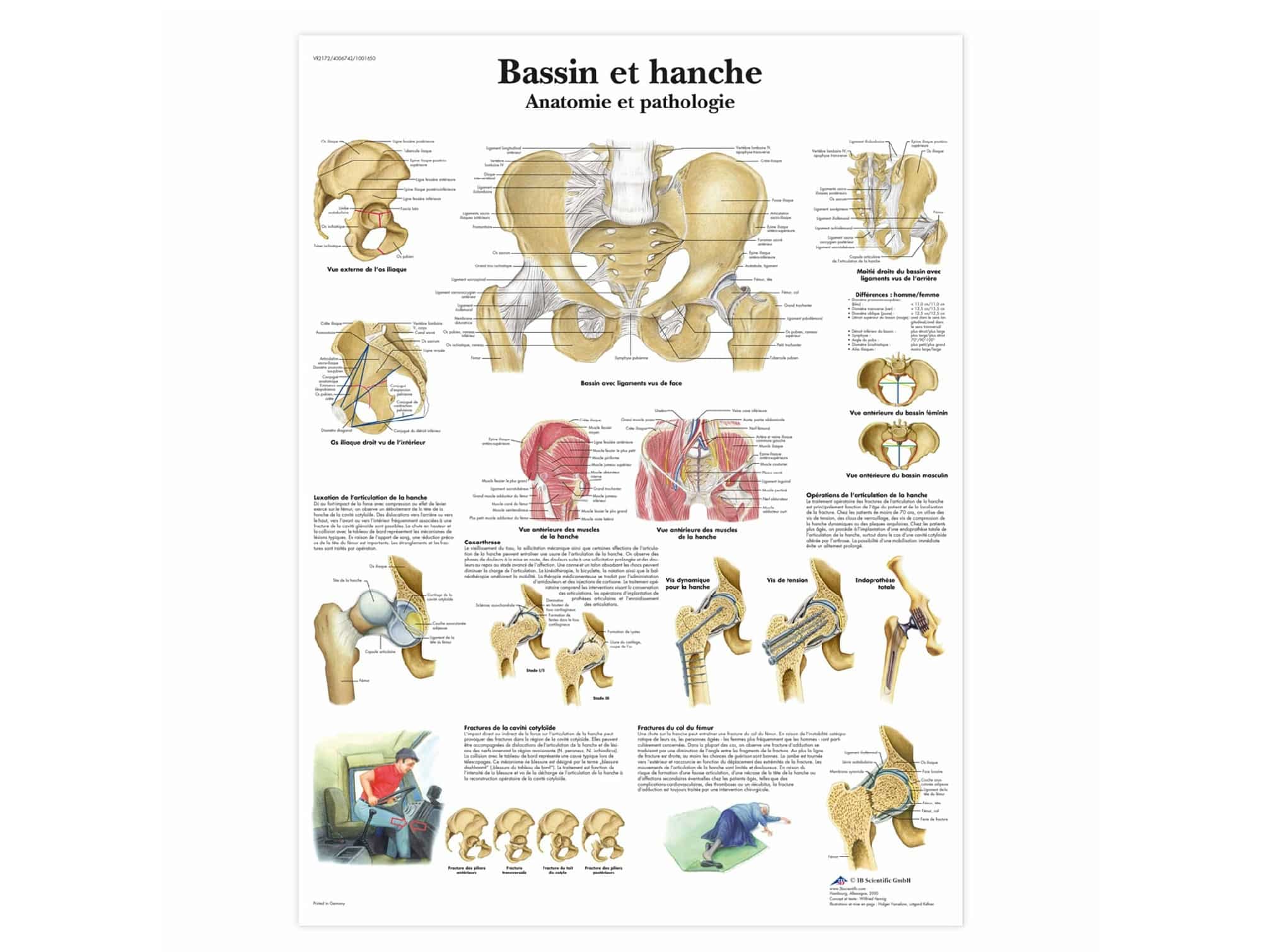 Anatomical chart Pelvis and hip - Anatomy and pathology (Locamed)