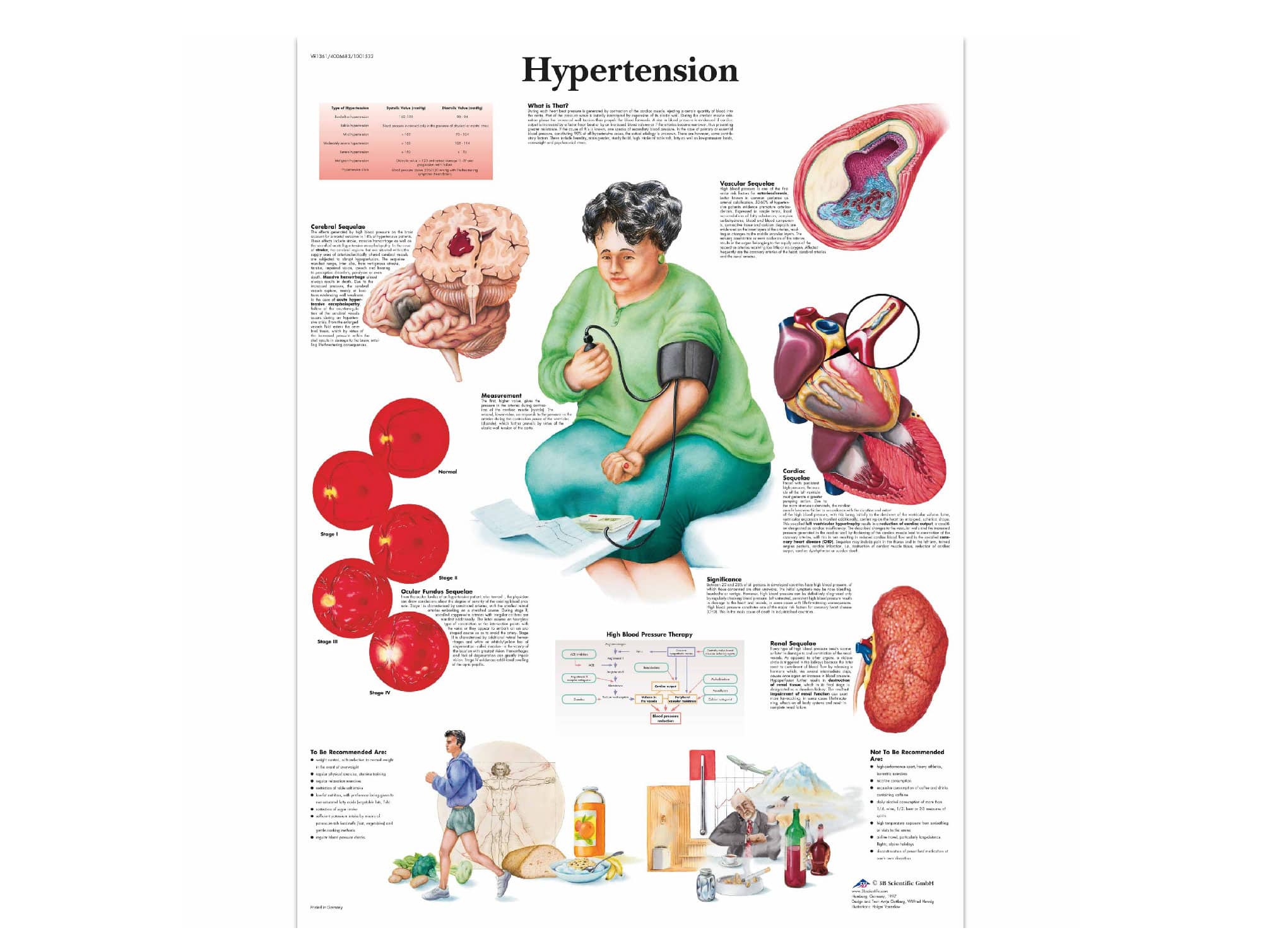 L’hypertension Locamed