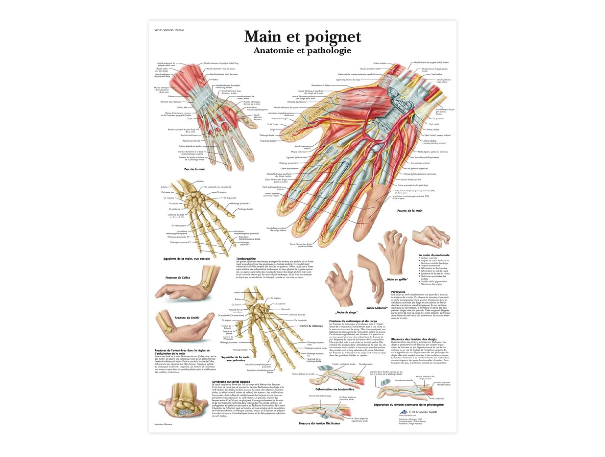 Main et wrist brace-Anatomie et pathologie
