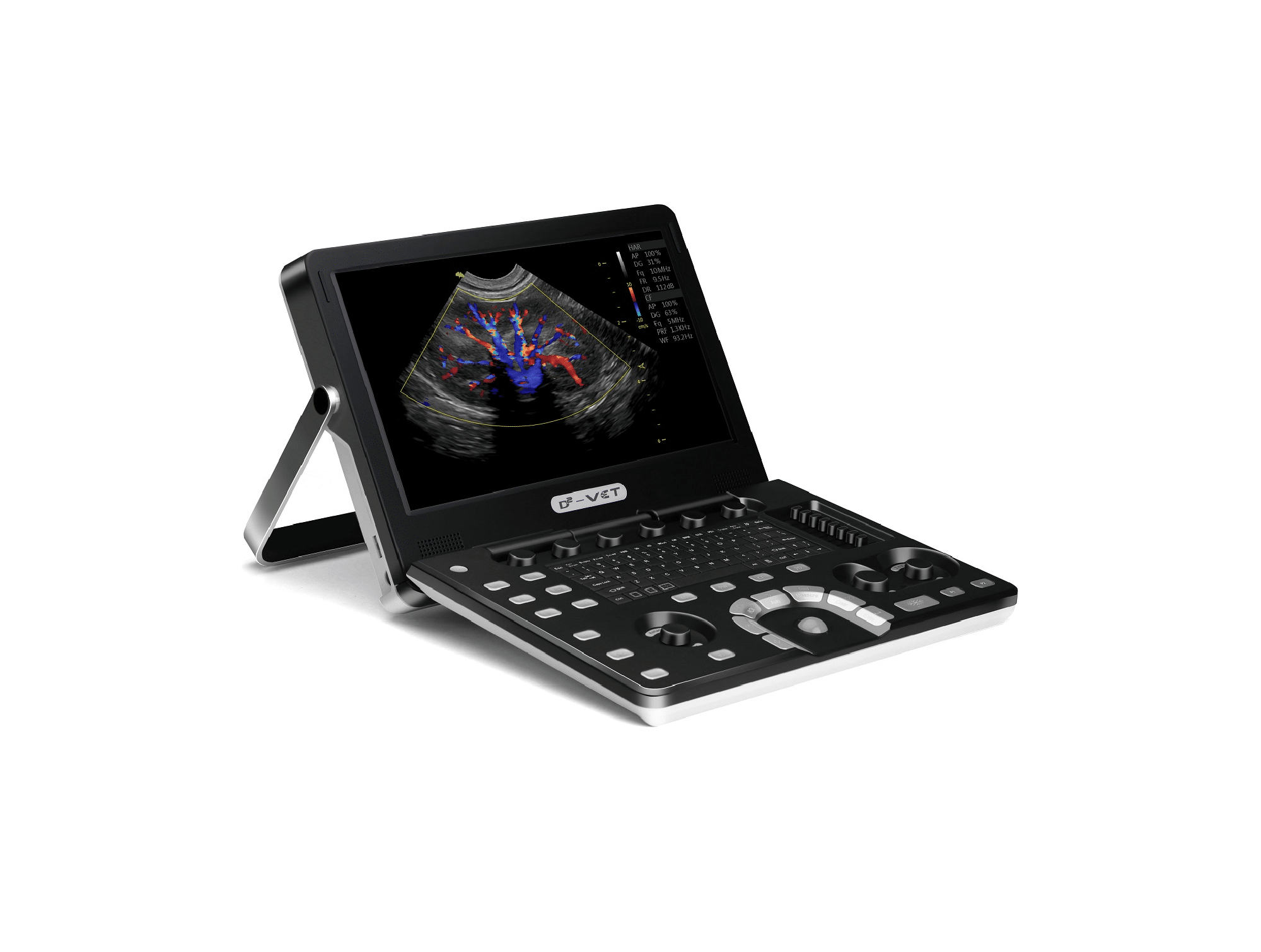 Echographe Vinno D2VET Porطاولة en Couleur